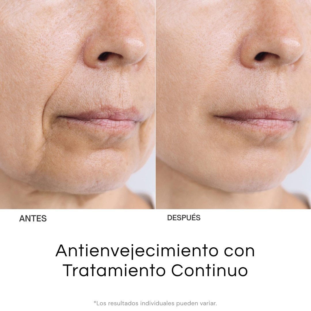 Intense LED Pro® Masajeador Facial y de cuello  7 en 1